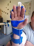 Sehnenerkrankungen Sehnenerkrankungen